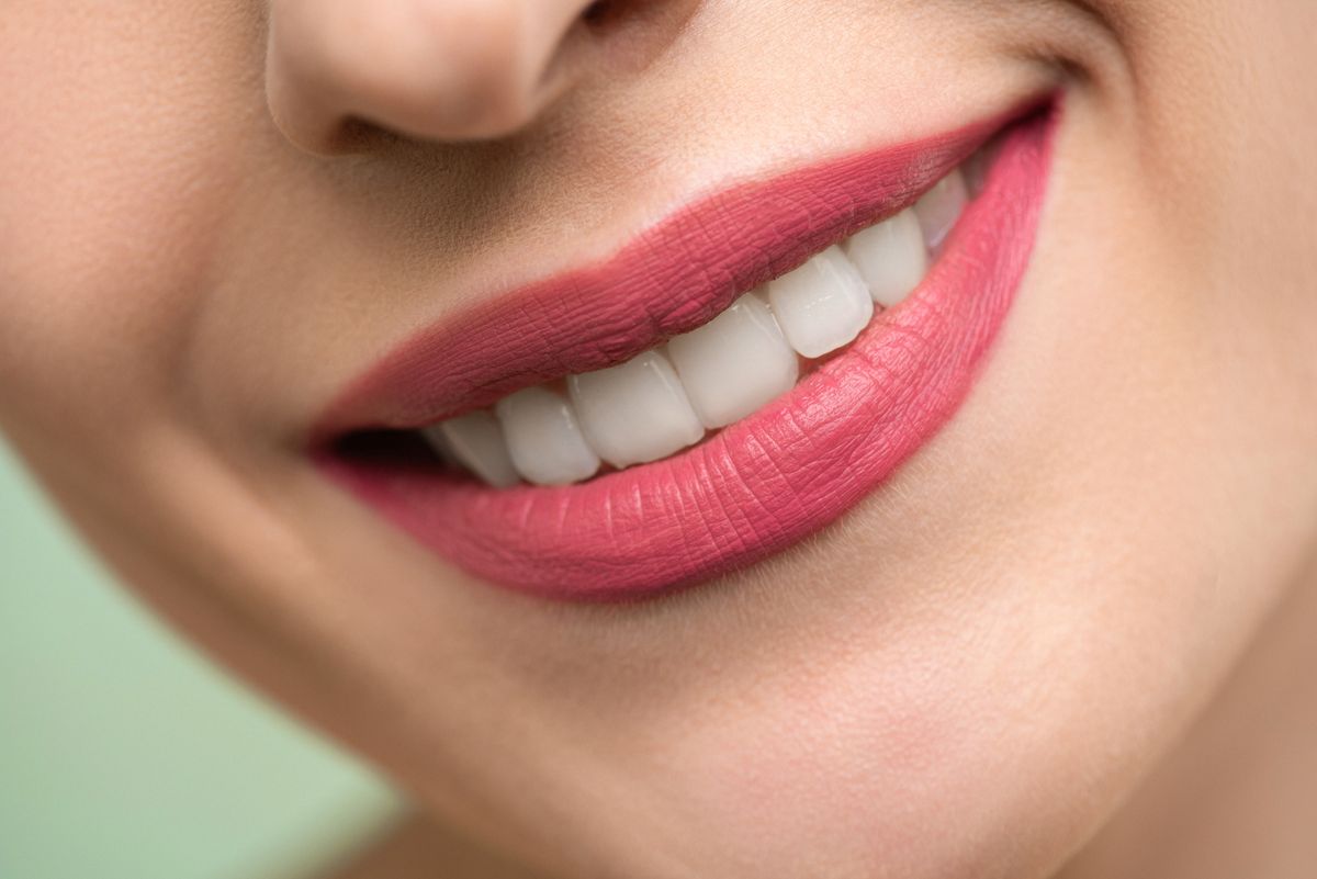 Smile Design